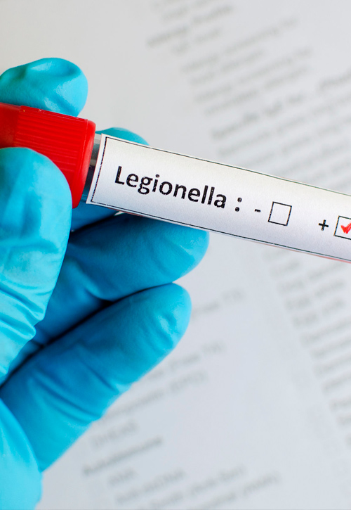 Legionella